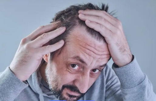 脱发都有哪些明显的症状表现呢?