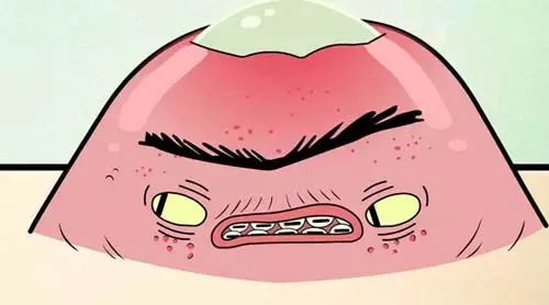 痤疮毛囊炎患者应当注意哪些事项?