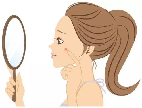 女性生理期为何痤疮频繁滋长呢?