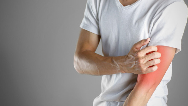 神经性皮炎出现皮损后会有水泡吗?