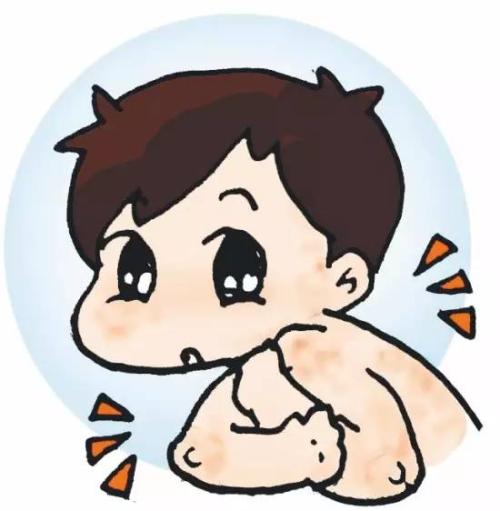 儿童湿疹反复是不是和体质有关呢?